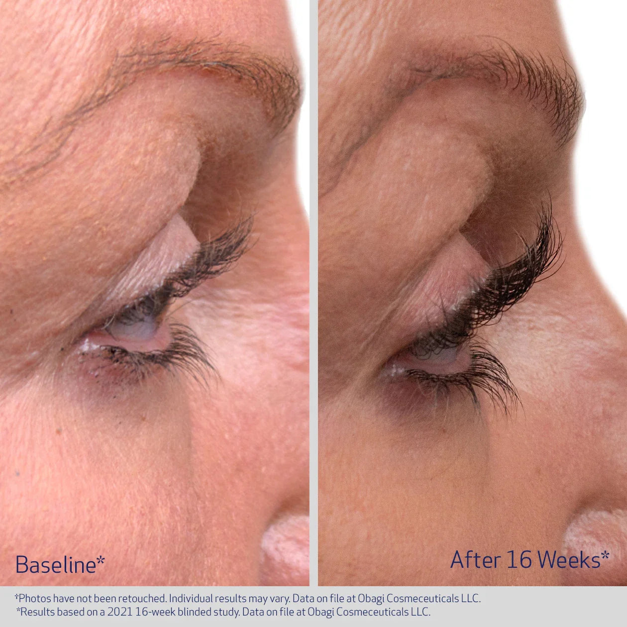Obaji - Nu-Cil Eyelash Enhancing Serum