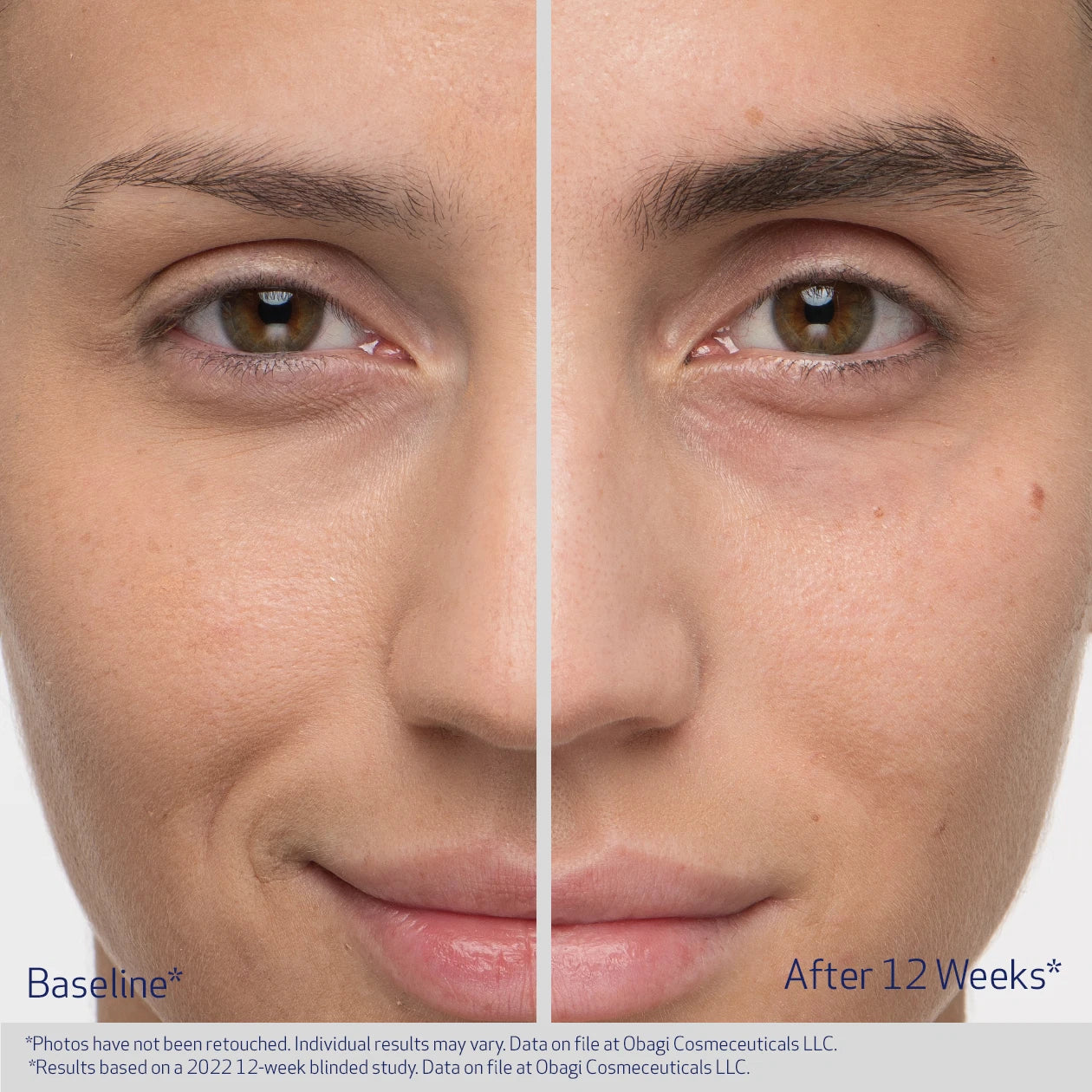 Obaji Nu-Cil Eyebrow Boosting Serum
