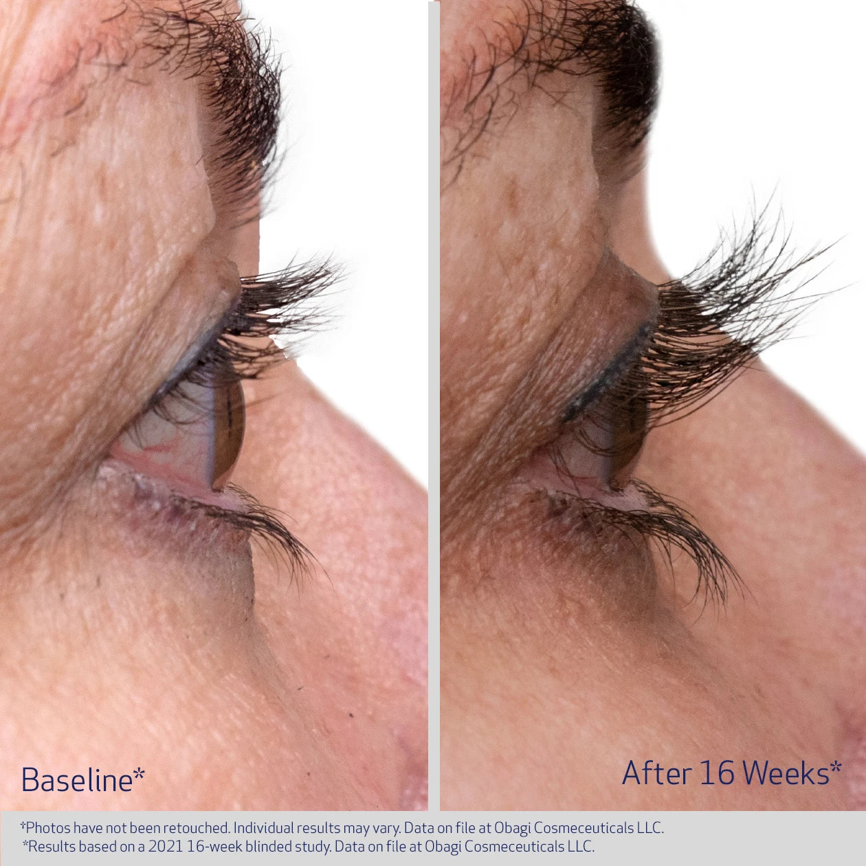 Obaji - Nu-Cil Eyelash Enhancing Serum