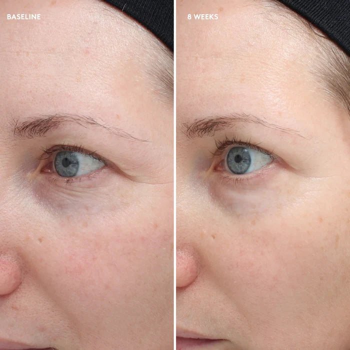 Colorescience - Total Eye Firm & Repair Cream - Skinandcare