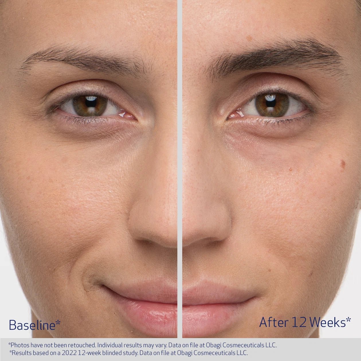 Obaji Nu - Cil Eyebrow Boosting Serum - Skinandcare